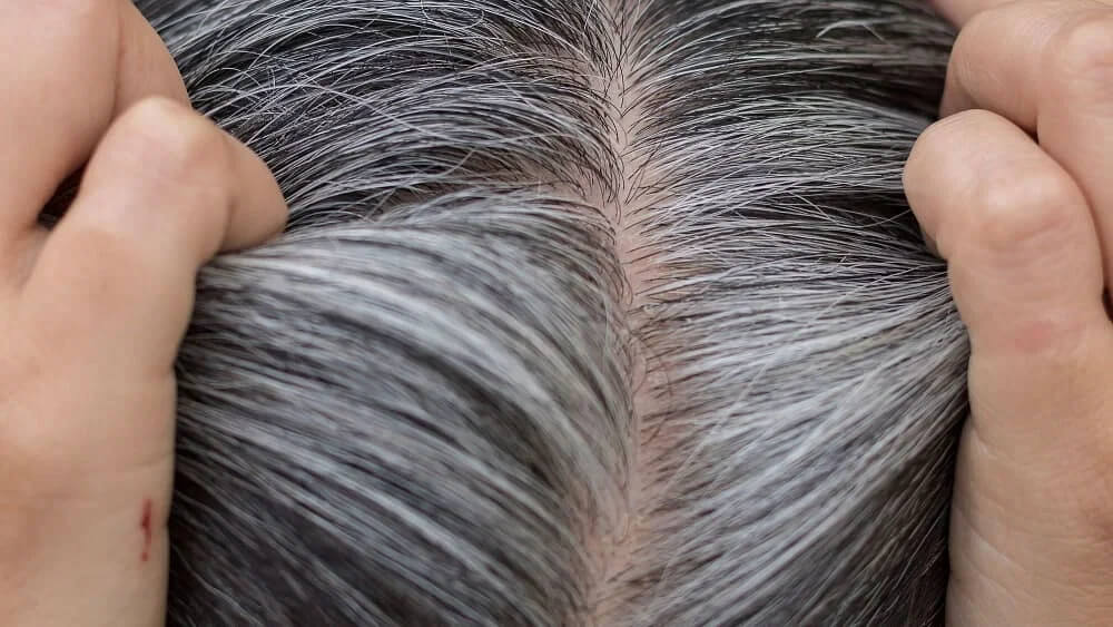 wellhealthorganic.com/know-the-causes-of-white-hair-and-easy-ways-to-prevent-it-naturally